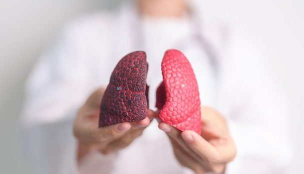 Interstitial lung disease management