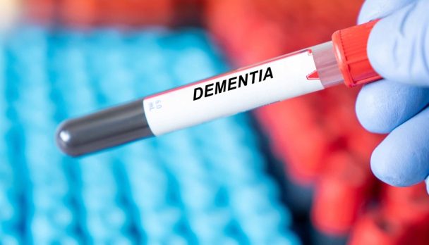 Dementia.,Dementia,Disease,Blood,Test,In,Doctor,Hand