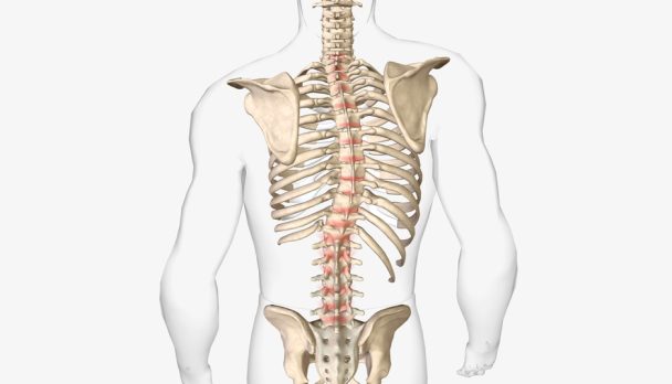 The,Spinal,Scoliosis,And,Kyphosis,3d,Rendering