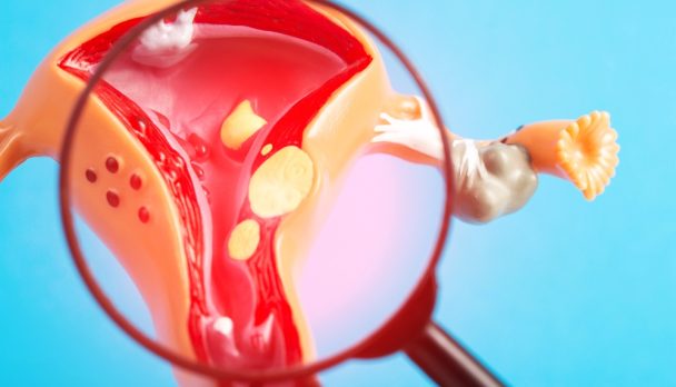 Medical,Mockup,Of,The,Female,Reproductive,System,Under,A,Magnifying